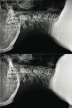 short -  - XraybeforeAFTER.tif