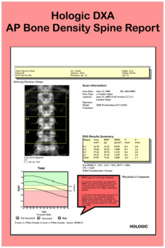 print a poster - Hologic Dxa - Open_House_Bone_Density_Spine_Report_1.tif