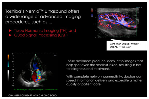 print a poster - Toshiba Nemio - Open_House_Ultrasound.tif