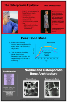 print a poster - Osteoporosis Information - Open_House___Bone_Density_Understandings.tif