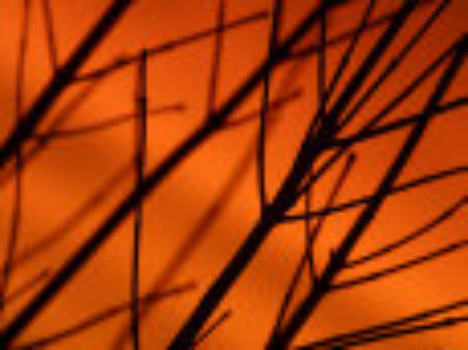 print a poster - Dry Trees - Branch_Pic.jpg