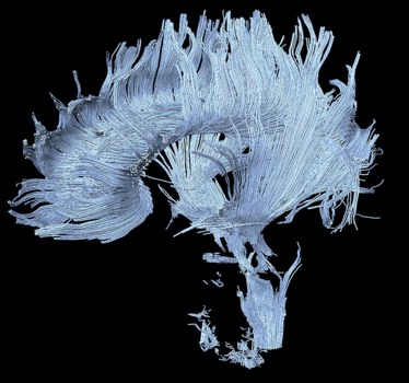 poster printing -  - neuron5.jpg