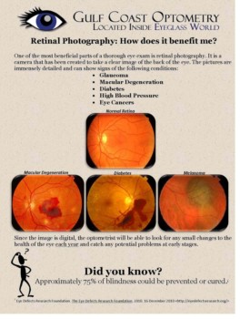 poster maker - Gulf Coast Optometry - Retinal_poster_2.jpg
