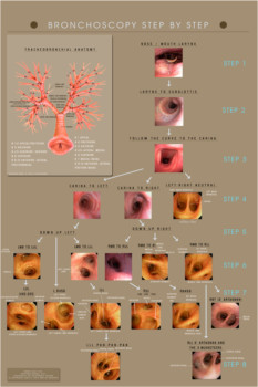 posterbrain -  - Bronchimage1.bmp