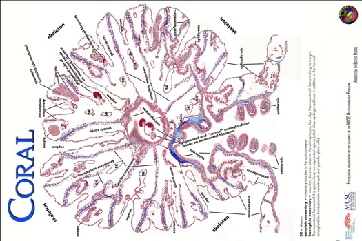 print a poster -  - coralhistopathology.tif