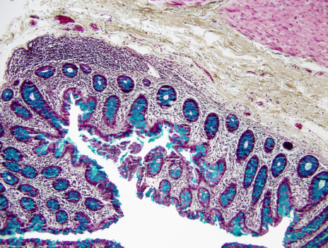 posterbrain - White - Bowel_Movat_1.jpg